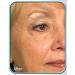 Stem Cell Therapy - Look & Feel Years Younger | Age-Defying Solutions Shipped Internationally - Buy Online on GoSupps.com