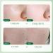 Centella Cleanser with 5X Centella Asiatica Activity 100g Deeply Clean Mild Hydrate & Moisturizing Repair Barrier Damage Soothing Cleanser for Oil Control and Acne Organic Extract - Buy Online on GoSupps.com