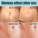 German Advanced Skin Renewal Gel Scar Gel For Acne Scars Stretch Mark Removal Cream Advanced Scar Treatment Natural Scar Therapeuti Gel Scar & Stretch Marks Remover Gel (3pcs) - Buy Online on GoSupps.com