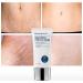 Stretch Mark Removal Acne Scar Stretch Fat Striae Gravidarum Treatment Repair Anti Aging Angles Firming Body Care (1 Piece) - Buy Online on GoSupps.com