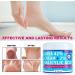 Urea Cream 42 Percent for Feet - 42% Urea Foot Cream with 2% Salicylic Acid & Hyaluronic Acid - For Feet Hands Heels Elbows Nails & Knees - 4 oz - Buy Online on GoSupps.com