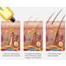 Ginaday Instant Ginger Hair Regrowth Shampoo 17.6oz - Hair Growth & Anti-Hair Loss Care - 500ml - Buy Online on GoSupps.com