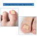 Fitmedify Toenail Correction Patch - 60 Pcs for Ingrown Toenail Prevention - Buy Online on GoSupps.com