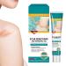 G n rique Anti-Scar Cream 20g Gel Treatment for Injuries Long-Term Care for Scars For Comfort Recovery Burn Protection Injury Domestic Body
