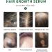 PrimeCove - Biotin & Tea Tree Hair Growth Serum (30ml) | Stimulate Growth Reduce Graying & Nourish Roots | Advanced & Natural Formula - Buy Online on GoSupps.com