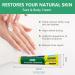 ACWOO Psoriasis & Eczema Relief Ointment - Soothes Dry, Itchy, Rough Skin and Fungal Infections - Buy Online on GoSupps.com