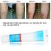 Varicose Vein Treatment Cream - Reduce Inflammation, Improve Circulation | Vein Lotion for Legs & Body - Buy Online on GoSupps.com