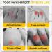 Silicone Toe Protectors - 20Pcs Set for Corns, Foot Pain Relief | Anti-Friction & Breathable Cap for Little Toes - Buy Online on GoSupps.com