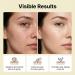 Retinol Gold Micro-Peptide Tallow Anti-Aging Serum with Beef Tallow Hydrates Firms & Improves Skin Elasticity Nourishing Facial Essence for Moisturized Lifted Skin 3.38 Fl Oz - Buy Online on GoSupps.com