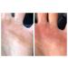 Callus Performance Healing Salve - Ideal for Gymnastics, Weightlifting, Crossfit, Rock Climbing & Rower - Hand & Feet Care Salve - Buy Online on GoSupps.com