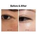 MEDITHERAPY VITA REAL Shot Clear Patch - Dark Spot & Acne Care Hydrocolloid Patch with Pure Vitamin C for Brightening | Korean Skincare (6EA - Buy Online on GoSupps.com
