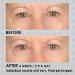 NassifMD Under Eye Smoother - Anti Aging Eye Cream for Dark Circles & Puffiness Firming Eye Serum for Women - Buy Online on GoSupps.com