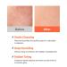 Hanskin Vitamin C Glow Duo Powder Facial Cleanser & Sheet Mask Set | Gentle Exfoliation Hydration & Radiant-Looking Skin | Korean Skincare Routine for Dull Dry & Sensitive Skin K-Beauty - Buy Online on GoSupps.com