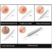 Dreneco 5Pcs Blackhead Remover Pimple Comedone Extractor Tool Acne Removal Kit Treatment for Blemish Whitehead Popping Zit Removing for Nose Face Skin with Metal Box - Buy Online on GoSupps.com