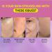 3PCS Mandelic Acid Body Serum Gentle Cleansing Pore Exfoliating Remover Smoothing Reduce Dryness - Buy Online on GoSupps.com