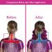Cervical Neck Traction Device - Rose Red Neck Support for Pain Relief & Spinal Pressure Relief - Buy Online on GoSupps.com