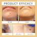  CongRong Set of 3 bee venom skin care creams professional bee poison cream to eliminate and repair impurities effectively firms the skin and reduces - Buy Online on GoSupps.com
