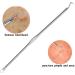 Acne Needle Stainless Steel Comedone Acne Blackhead Remover Needles Pimple Blemish Black Dots Skin Face Care Tools Clip Spoon Kit (Color : Peach) - Buy Online on GoSupps.com