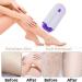 2022 New Silky Smooth Hair Eraser - Painless Hair Removal with Light Technology - Color-1 - Buy Online on GoSupps.com