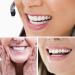 2 Pairs of Fake Teeth Veneers for Men and Women - Cosmetic Tooth Repair Kit - Buy Online on GoSupps.com
