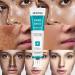 Go Ho Skin Whitening Cream | Skin Bleaching & Dark Spot Remover for Face & Body | Lightening Cream for Intimate Areas Armpits Knees & Elbows | 1.06oz - Buy Online on GoSupps.com
