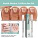KARLOR nail care pencil set 2 pieces of nail fungus pen nail care pencil against nail fungus nail mushroom nail care pen nail care pen nails care gap toenails - Buy Online on GoSupps.com