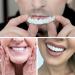 Denture Teeth Veneer Set - Natural Shade Fake Cover for Upper and Lower Jaw - Men Women Braces - Confidence-Boosting Smile Fix | 4PCS - Buy Online on GoSupps.com