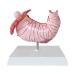 Human Stomach Lesion Model with Diaphragm Model Digestive System Model gastric Ulcer Model