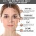 2% Alpha Arbutin + Hyaluronic Acid Facial Serum - Brightening Serum for Dark Spots Fade Acne Scars & Pigmentation - Helps Reduce The Appearance of Melasma & Blemishes - 1 Fl Oz (1) - Buy Online on GoSupps.com