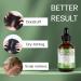 Rosemary Oil For Hair Growth Skin Care Eyelashes & Eyebrows. Rosemary Oil Stimulates & Strengthens Hair Growth Oil Pure Rosemary Essential Oil Hair oil For Men & Women (60ml) - Buy Online on GoSupps.com