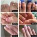 Nail Treatment 1PC Nail Treatment Nail Renewal Solution Toenails & Fingernails Nail Repairs Essential Oil Protects From Discoloration Brittle And Cracked Nail(12ML) - Buy Online on GoSupps.com
