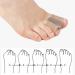 Soft & Comfortable Toe Spreader - 4-Part BalanCorrect for Overlapping Toes - Unisex Solution - Buy Online on GoSupps.com