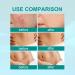 Southmoon Medical Grade Scar Spray - Advanced Solution for Acne, Surgical Scars, and Stretch Marks - Lighten Scars and Smooth Skin - 1pcs - Buy Online on GoSupps.com