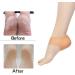 Madholly Gel Heel Sleeves - 5 Pairs | Breathable Silicone Heel Socks for Dry Cracked Heel, Plantar Fasciitis, Achilles Tendonitis, Heel Spurs, Sore Heel - Buy Online on GoSupps.com