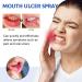Mouth Ulcer Spray - 30ml Antibacterial Relief for Mouth Wounds & Soothing Care - Buy Online on GoSupps.com