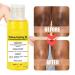 Super Strength Yellow Peeling Oil for Dark Skin - 30/50ml Exfoliating Lightening Treatment - Extra Strength for All Skin Types - Buy Online on GoSupps.com