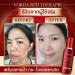 Vorda Red Therapie Serum Facial 30ml - Korean X50 Photoglow for Radiant Skin | International Shipping - Buy Online on GoSupps.com