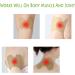Wellness Knee Patches | 50 Pcs Herbal Wormwood Relief Stickers for Knee & Back Pain - Buy Online on GoSupps.com