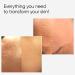 AME Pure CIT Face Roller - Microneedling Roller for Collagen Boost - Premium Quality Micro Needling Roller - Derma Roller 0.5mm - Derma Roller for Face That is Laser Treatment Alternative - Buy Online on GoSupps.com