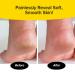 Buy PedEgg Power Cordless Motorized Callus Remover - LED Light 2000 RPMs for Smooth Feet As Seen On TV - Buy Online on GoSupps.com