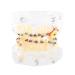 Tooth Model for Orthodontic Treatment - Wire Chain & Brackets | Dental Study Model for Precise Diagnosis & Planning - Buy Online on GoSupps.com