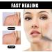 Aobenz Serum | Aobenz Whitening and Freckle Removing Essence | Aobenz Anti-Spot Serum Aobenz Spot Remover Serum Aobenz Dark Spot Correcting Serum Brightening and Removing Freckles (2Pcs) - Buy Online on GoSupps.com