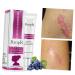 DOITOOL Scar Cream - Face & Body Scar Remover Gel for Wrinkles & Blemishes - Skin Repair & Plastic Surgery Recovery - 1 Count - Buy Online on GoSupps.com