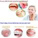 Wenplus 10 Pack Dental Wax for Braces - Orthodontic Wax in 10 Colors & Flavors | Best Oral Care for Braces Wearers - Buy Online on GoSupps.com