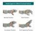 Finger Training Board - Orthotic Solution for Stroke Hemiplegia & Brain Injury | Prevent Flexion Contractures - Buy Online on GoSupps.com