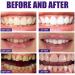 Bisindole Toothpaste for Repair & Whitening | Probiotic Formula Removes Stains & Freshens Breath - Consentbil - Buy Online on GoSupps.com