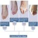 Hallux Valgus Correction - Adjustable Bunion Corrector & Toe Smoothing Relief for Left Foot - Buy Online on GoSupps.com