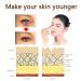 Buy Sonew Eye Cream - Anti-Aging Moisturizing Eye Serum for Bags Circles & Swelling | International Shipping - Buy Online on GoSupps.com