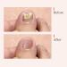 Fungal Nail Treatment for Toenails Extra Strong Nailtroe Toe Nail Fungus Treatment for Toenail Nail Repair Growth Treatment Nail Softener for Thick Toenails - Buy Online on GoSupps.com