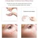Blackhead Remover Pimple Comedone Extractor Tool Acne Kit - Treatment for Blemish & Whitehead Removal - Nose & Face Skin Care Tool (Gold) - Buy Online on GoSupps.com
